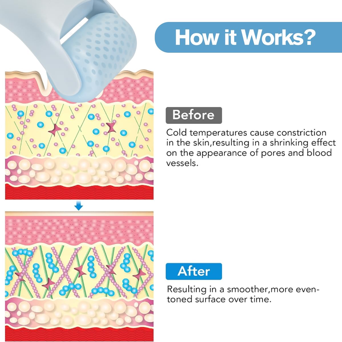 Fronnor Facial Ice Roller